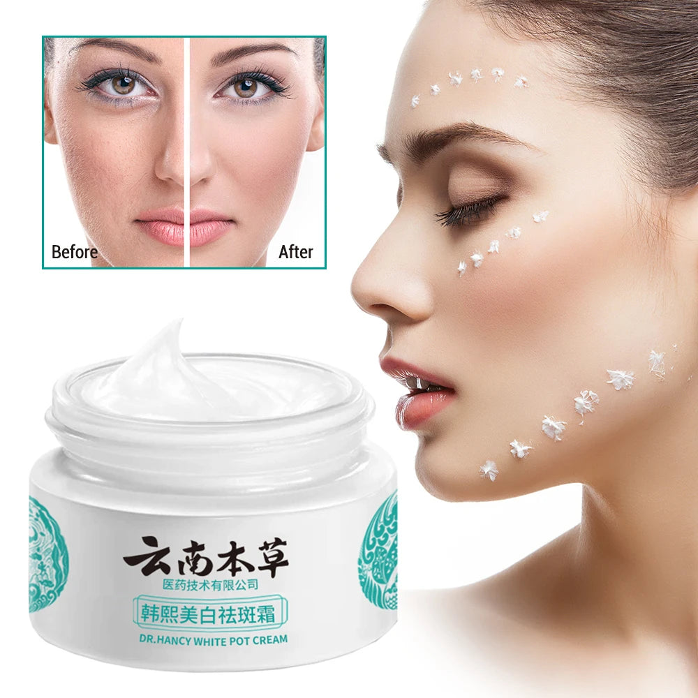 [COMBO SALE] Whitening Spot Lightening Cream Yunnan Herbal Freckle - Made By Japanese