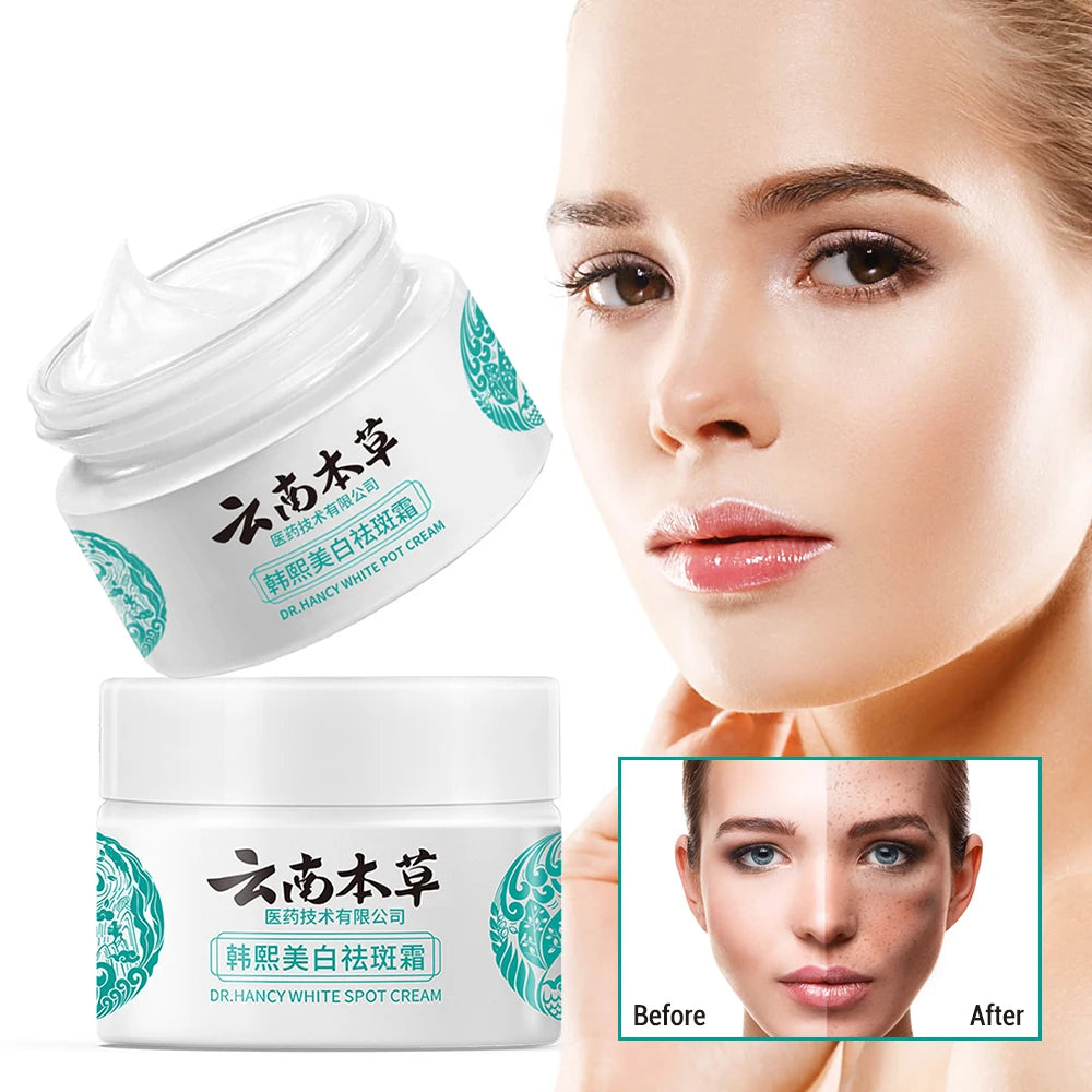 [COMBO SALE] Whitening Spot Lightening Cream Yunnan Herbal Freckle - Made By Japanese